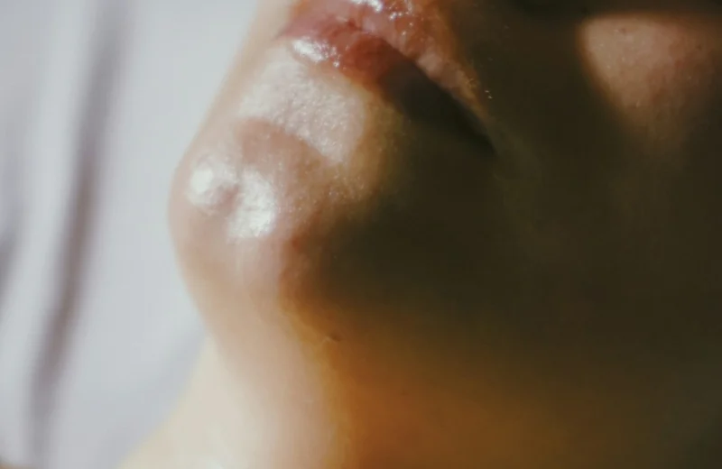 Hydrafacial skin rejuvenation treatment at Alchemy Clinic, Bangalore