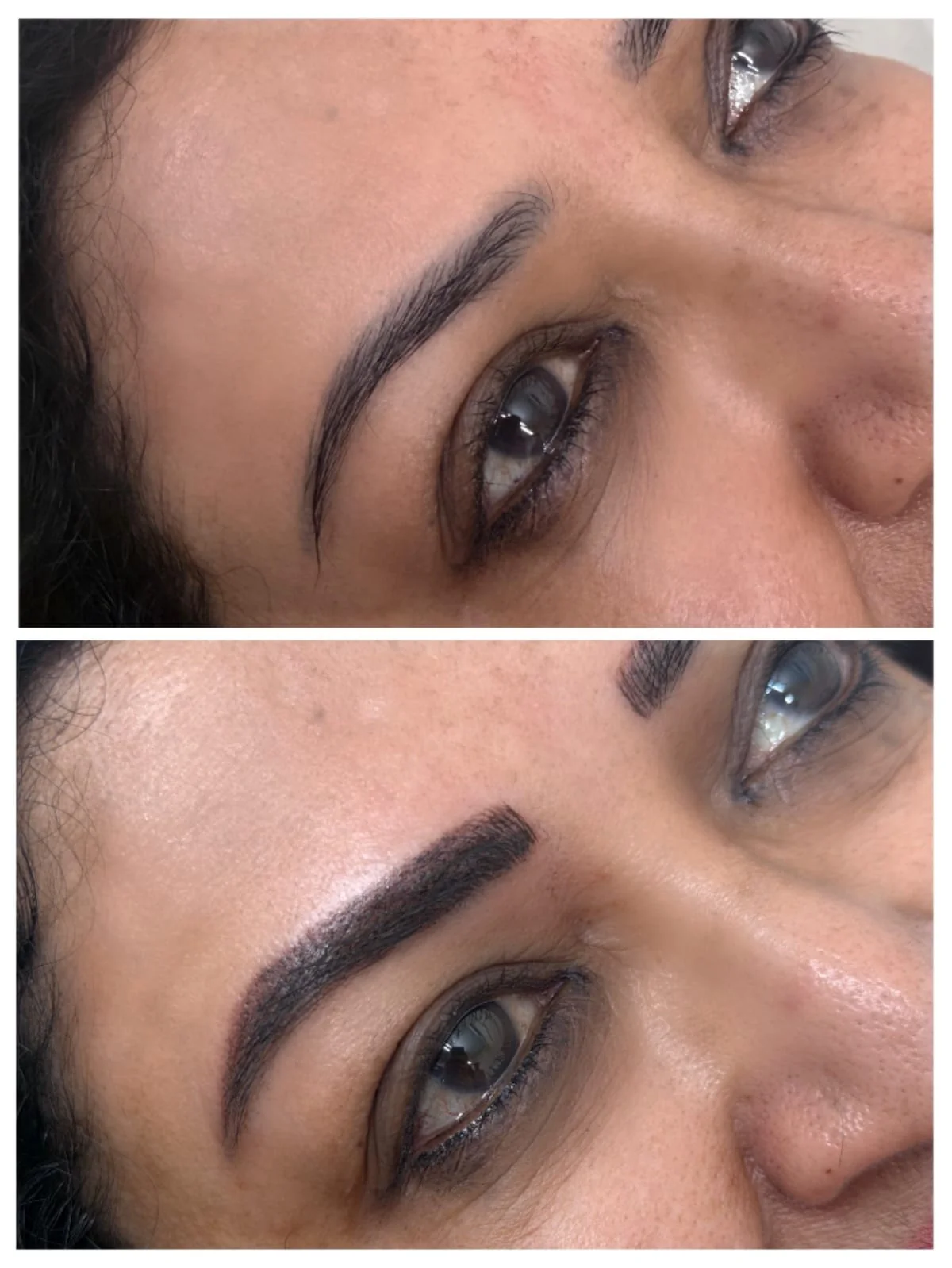 Eyebrow Microshading at Alchemy Clinic, Bangalore