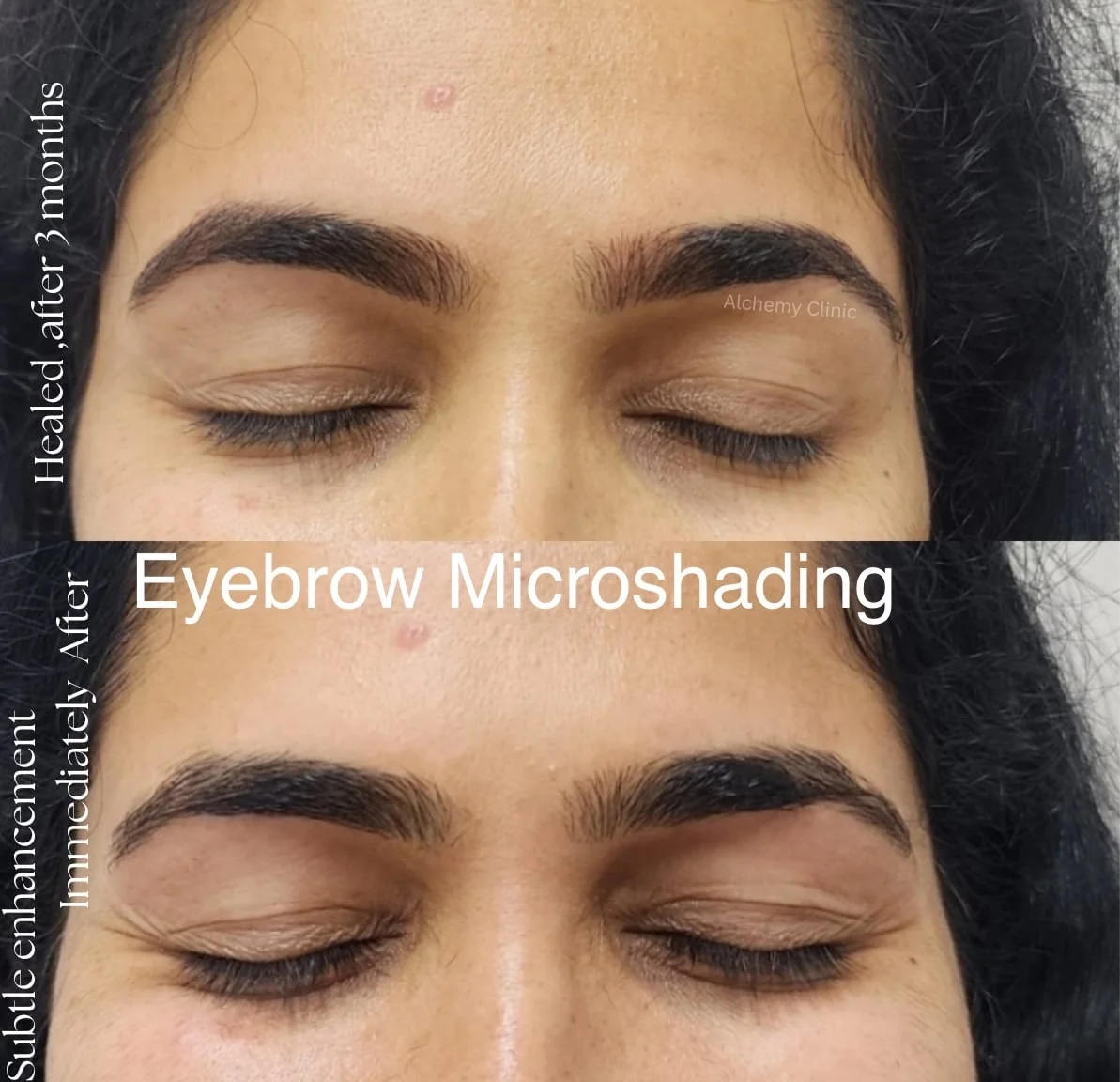 Microshading Results Alchemy Clinic Singasandra at Alchemy Clinic — Microblading, Bangalore